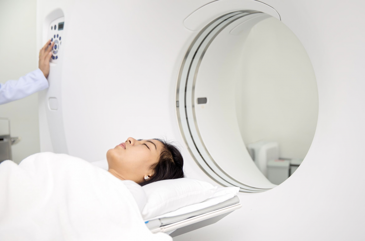 Peran CT Scan dan MRI dalam Diagnosis Stroke